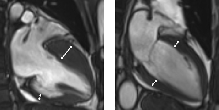 ȣŹ, Ƿ, ǰ, ļ ɱٺ,  Ȼ꺴,  