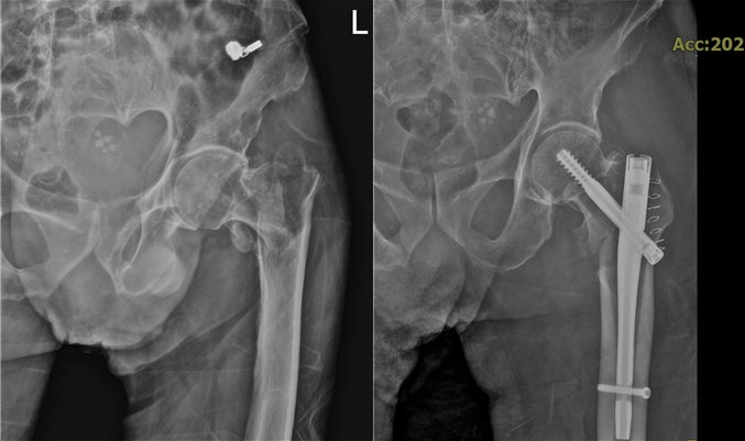 ȣŹ, , Ѹ, 100 ʰȯ,  