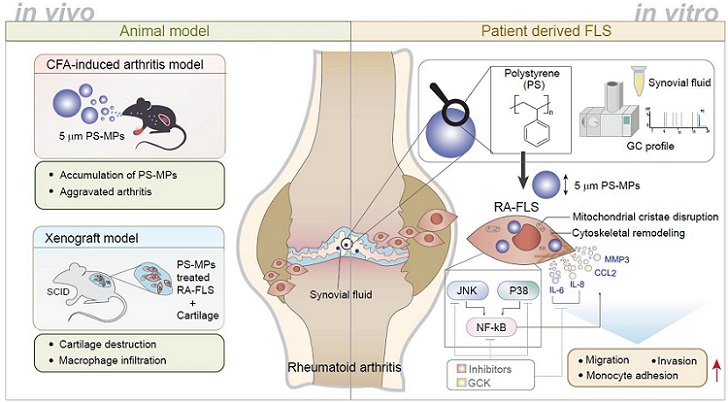 °£È£»ç½Å¹®, º¸°ÇÀÇ·á, ·ù¸¶Æ¼½º °üÀý¿°, ¹Ì¼¼ÇÃ¶ó½ºÆ½, °¡Å縯´ë, Æ÷½ºÅØ