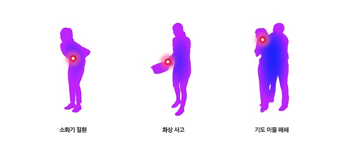 ��ȣ��Ź�, �����Ƿ�, �ǰ�����, ���ϻＺ����, �� ���� ���޽�, �ܰ� ���, ���漺 ����